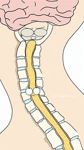 Why Bad Posture Turns Into a Tech Neck Hump? | Darren Healthcare