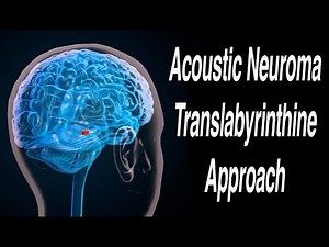 Translabyrinthine Approach to Acoustic Neuroma Surgical Removal