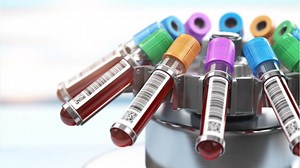 LifeLabs says the personal information — possibly including health card numbers — of an unknown number of the company’s 15 million Canadian customers was stolen in a data breach in October. READ MORE: https://bit.ly/2PUCLYj | Global News