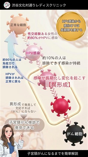 子宮頸がんになるまでのプロセスを簡単図解！
