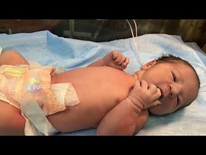 First assessment of newborn