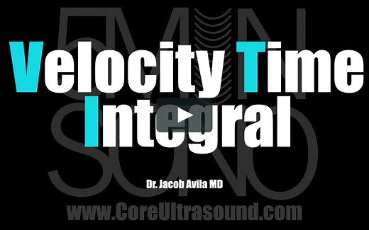 Velocity Time Integral (VTI) 2021