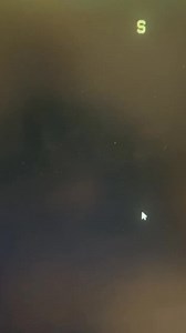 13K views · 86 reactions | Bone Scan SPECT/CT. Patient had no idea there was a hole in their skull and their brain was showing 易 | Radiology - 1895 | Facebook