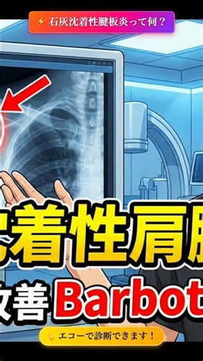 肩が突然激痛に…それ石灰かもしれません