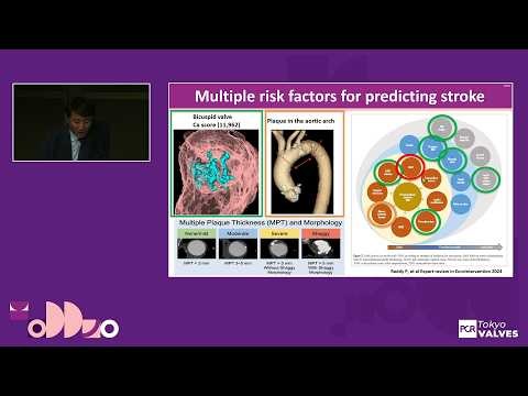 Protect the brain for TAVI - True potential of SENTINEL Cerebral Protection System