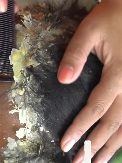 Dandruff world — calm, clear, and deep. | The Flake Doctor