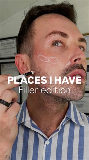 I often get asked, “What have you had done?” so here it is, my Filler Edition 💉✨ Over the years of being an injector, I’ve learned that the secret to looking natural is PLANNING. Some of you are shocked saying: “Wow, you look so natural!” “I’d never know you had anything done!” …and that’s exactly the goal 👀 Natural aesthetic treatments should be undetectable, just beautifully balanced. I plan my treatments ahead, stay consistent, and maintain my results every 6–7 months nothing overdone, just