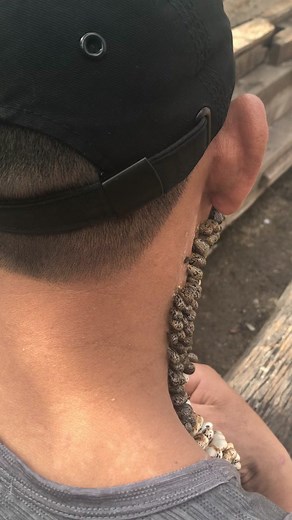 Understanding Ticks and Lice: Identification and Prevention