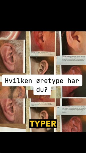 Ørelesing: Hva Ørene Dine Avslører Om Deg