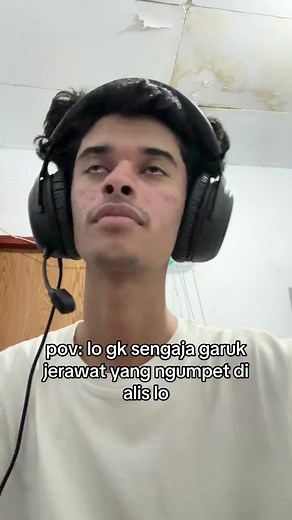 Mengatasi Jerawat di Alis: Rekomendasi dan Tips