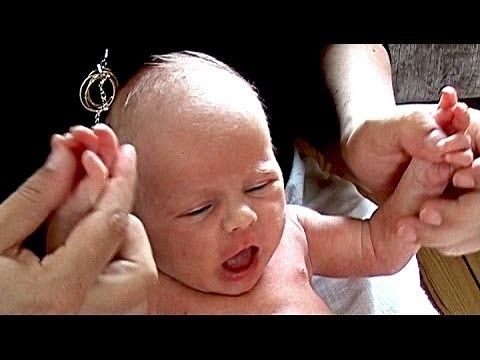 Babkin (palmomental) reflex / reaction