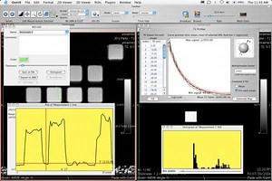 Activate Dicom Editing Osirix Lite