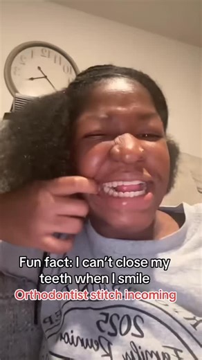 Dr. Su Lee DMD MSD | 이수정 on Instagram: "An open bite isn’t just an aesthetic concern. It can also cause functional problems, speech issues, and even psychosocial challenges. The good news is that many open bites can be prevented by stopping harmful habits early🦷 #orthodontics #orthodontist #openbite #wabisabi #smile #pediatrics #fingersucking #pacifier #habits #braces #dmv #aligners #invisalign #speech #myofunctionaltherapy #tongue #posture #breathing #airway #치과 #교정 #치과의사이수정 #교정전문치과 #maryland 