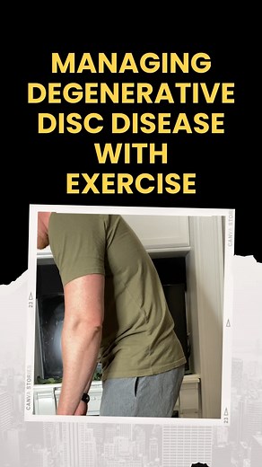 Discover effective ways to manage Degenerative Disc Disease (DDD)...