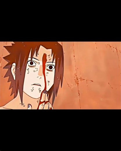 Itachi Uchiha Death 💔🥀 | Naruto Shippuden Edit 😢 #animeedit #anime #naruto #shorts