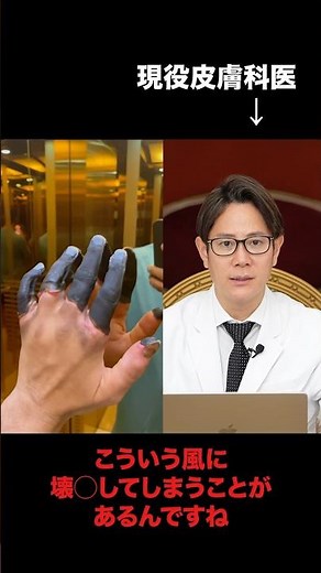 [Shocking] Blackened Fingertips, Tissue Necrosis A Dermatologist Explains the Dangers of Frostbite