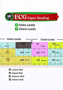 ECG Basics Explained part 2 | Complete Beginner Guide to ECG Interpretation Description: Learn the basics of ECG interpretation in this simple and professional guide. In this video, you will understand: #ECG #ECGBasics #ECGInterpretation #Cardiology #Nursing