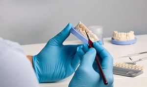 A Closer Look at Dental Crowns: Types, Materials, and Benefits