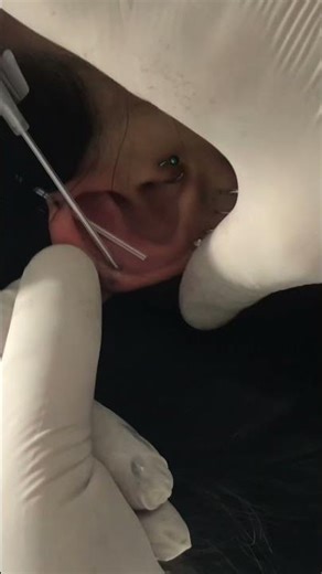 İndustrial, Köprü piercing işlemi #piercing #ankara #köprü #industrial #kulak #dudak