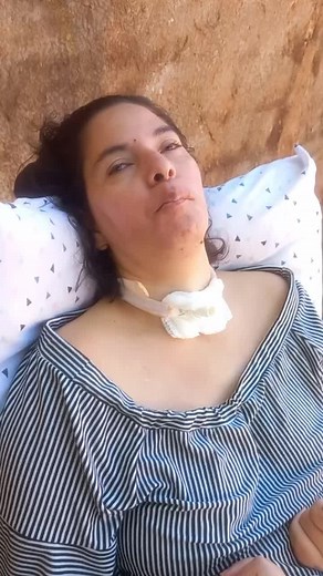 Understanding Respiratory Support Devices