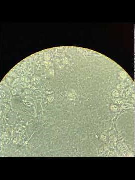 Bacterias al MICROSCOPIO