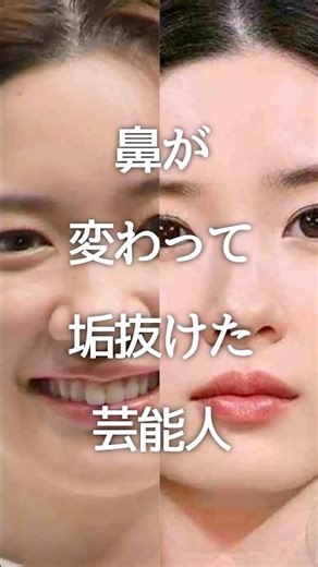 Celebrities who have changed their noses and become more refined #GalChan #Celebrities #Shorts