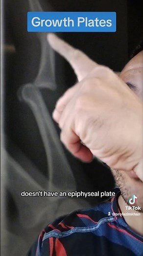 Growth plates - epiphyseal plates of bone