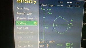 呼吸力学 流速--潮气量 环图曲线