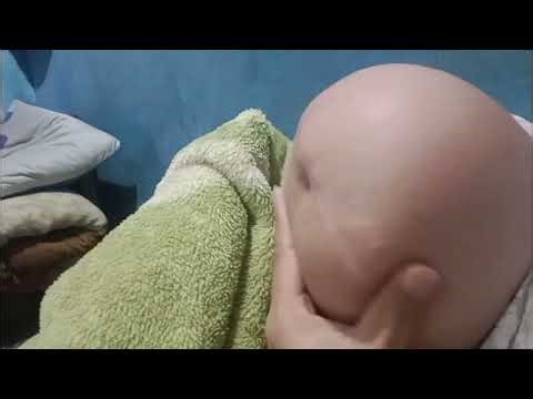 How To Massage Amputee Stump - One Legged SAK Amputee Woman Stump - AK Amputee Girl Stump Massage 