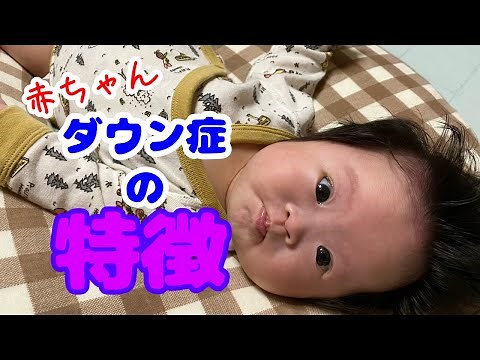 【ダウン症】特徴まとめ【生後1ヵ月】