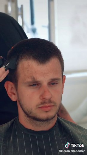 Receding Hairline Buzzcut: Tips and Styles for Men