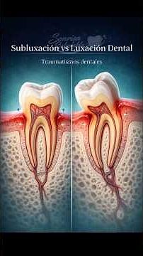 DENTAL SUBLUXATION VS LUXATION.