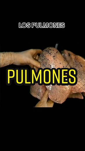 Los pulmones! Dr. Acland #pulmon #pulmones #lospulmones #pleura #sistemarespiratorio #anatomia #medicina #kinesiologia #enfermeria #aprendeanatomia #aprendemedicina #estudiantedeenfermeria #estudiantedekinesiologia #interesante #datosmedicos #cienciatiktok #cienciaentiktok