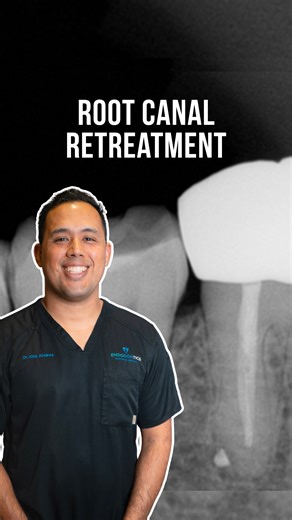 1.2K views | Why does my tooth still hurt after a root canal? 醴 Mild soreness is normal, but strong or persistent pain can mean a canal that needs retreatment  That’s why it’s so important to see certified dentists/endodontists. At TJ Endodontics we’re here to help with retreatment if needed.  DM us to schedule your visit, we take most PPO insurances. #rootcanaltreatment #tijuanadentist #rootcanal #tijuanaendodontist | TJ Endodontics | Facebook