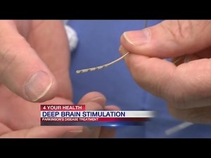 Deep brain stimulation procedure has high success rate for patients with Parkinson's Disease