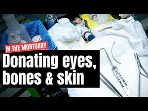 Mortuary work: Cleaning up after body parts donation