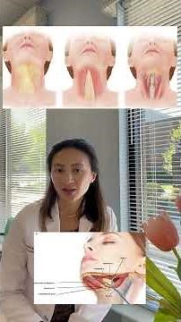 Neck Contouring Surgery - What does it take? - Dr. Catherine Weng