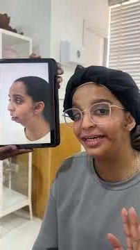 New Face - New Beginnings -Before After Transformation for one of our dear Patients