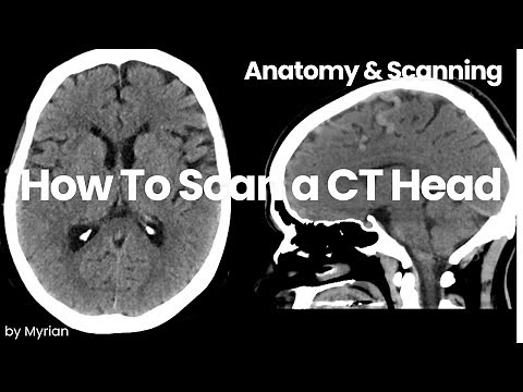 Introduction to CT Head: Anatomy Review and How To Scan a CT Head