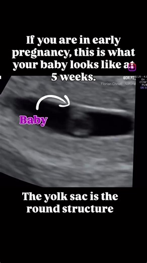 Understanding Your Baby’s Development at 5 Weeks