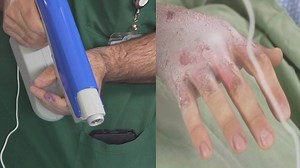 252K views · 23 reactions | This treatment can be a huge relief for burn victims. | A Plus | Facebook
