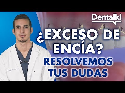 Tratamiento SONRISA GINGIVAL y ENCÍAS RETRAÍDAS - Gingivectomía e injerto de encías | Dentalk! ©️