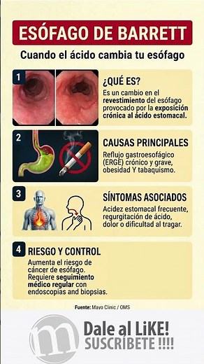 🔥 ESÓFAGO DE BARRETT: Cuando la acidez cambia tu cuerpo 🩺