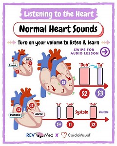 CardioVisual: Powered by MedicalVisual on Instagram: "Sound on! 🔊 Swipe through & read here Normal Heart Sounds high yield notes! 🫀 @rev.med Heart Sounds 🫀& Auscultation 🩺 ✅ Overview Heart sounds are produced from a specific cardiac event such as a closure of a valve or the tensing of the chordae tendinae. Main heart sounds are S1 & S2. The S3 can be normal, at times, but may be pathologic. The S4 is always pathologic. Closing of the valves causes audible sounds. 