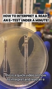 185K views · 2.9K reactions | How to interpret and read an E-Test (Epsilometer Test) in under a minute! What do you think the daptomycin MIC (minimum inhibitory concentration) is? . #phdmemes @topfans #microblading #science #ad | Microbiologists | Facebook