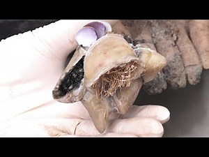 Extremely Long Toenails, Abnormal Growth Of Black Mud 👣 Professional pedicure process #270532