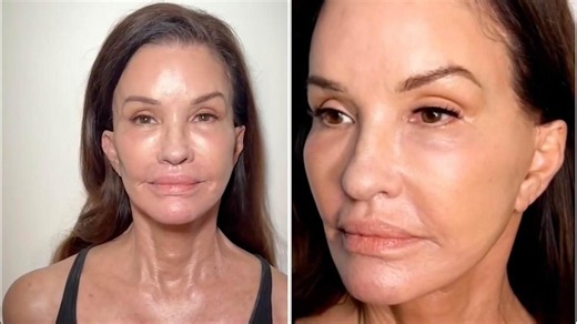 Video: Janice Dickinson reveals the before and after of her facelift | Daily Mail Online