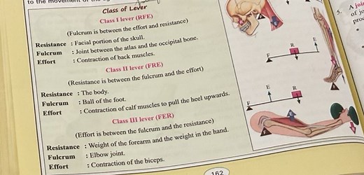 Explain the differences between Class I, Class II, and Class II... | Filo