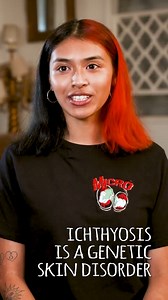 Nyla has Ichthyosis - meaning her skin grows extremely fast 💜 #fbreels #borndifferent #ichthyosis #skincondition #parenting | Born Different