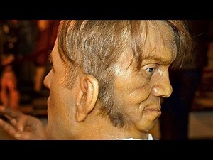 Top 5 People With Strange Bodies – Part 2